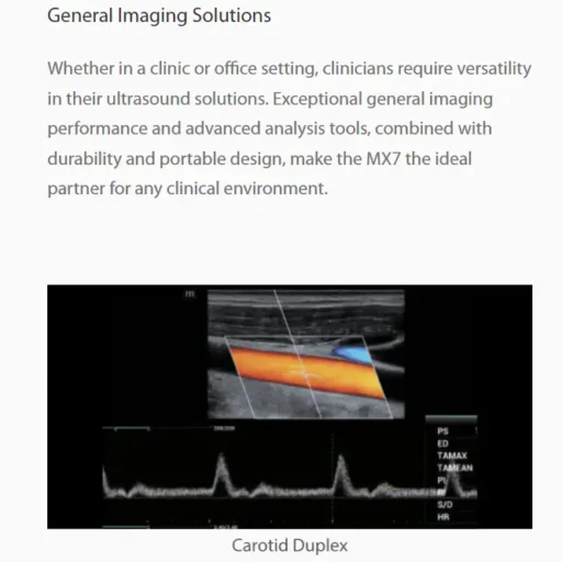 Mindray™ MX7 Portable Ultrasound System - Mindray USA - Image 3