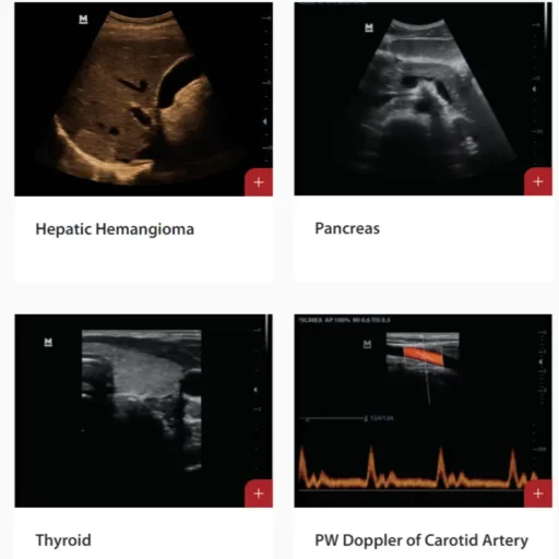 Mindray™ DP-50 Expert Portable Ultrasound System - Mindray USA - Image 2