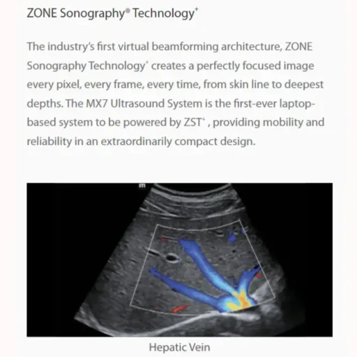 Mindray™ MX7 Portable Ultrasound System - Mindray USA - Image 4