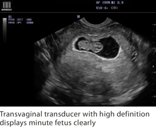 Mindray™ M7 Portable Ultrasound System - Mindray USA - Image 4