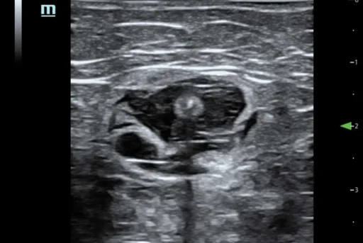 Mindray™ TE5 Ultrasound System - Mindray USA - Image 7