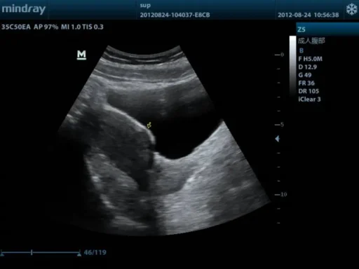 Mindray™ Z5 Portable Color Ultrasound System - Mindray USA - Image 7