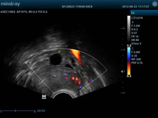 Mindray™ Z5 Portable Color Ultrasound System - Mindray USA - Image 4