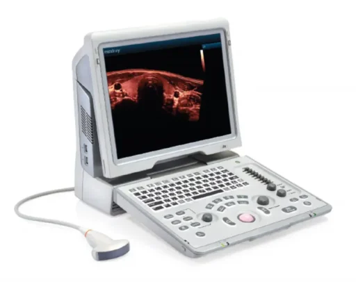 Mindray™ Z6 Portable Ultrasound System - Mindray USA