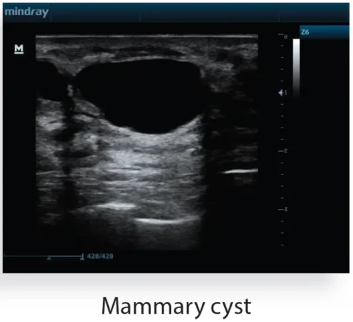 Mindray™ Z6 Portable Ultrasound System - Mindray USA - Image 5