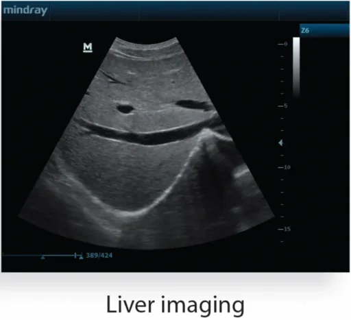 Mindray™ Z6 Portable Ultrasound System - Mindray USA - Image 4