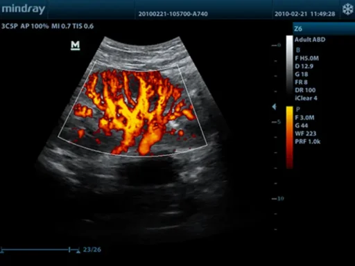 Mindray™ Z6 Portable Ultrasound System - Mindray USA - Image 2