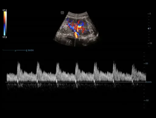 Mindray™ DC-40 Primary Care Ultrasound System - Mindray USA - Image 6