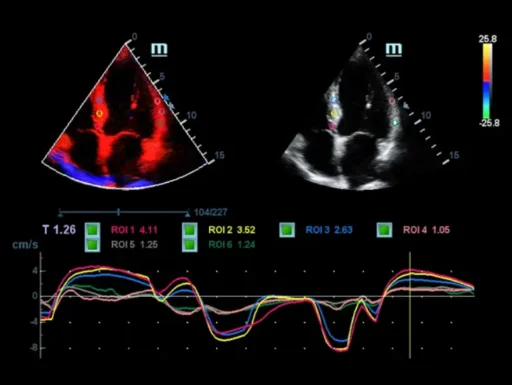 Mindray™ DC-40 Primary Care Ultrasound System - Mindray USA - Image 4