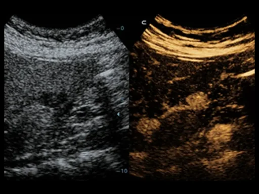 Mindray™ DC-40 Primary Care Ultrasound System - Mindray USA - Image 3