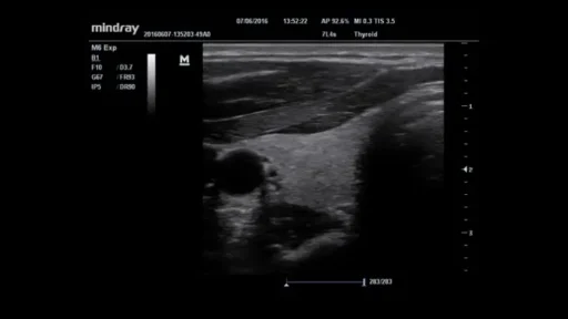 Mindray™ M6 Point of Care Ultrasound System - Mindray USA - Image 6