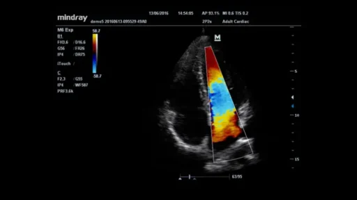 Mindray™ M6 Point of Care Ultrasound System - Mindray USA - Image 2