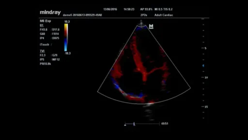 Mindray™ M6 Point of Care Ultrasound System - Mindray USA - Image 3