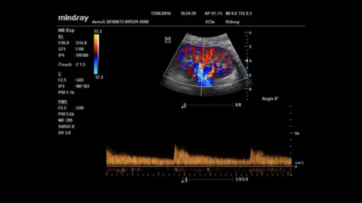 Mindray™ M6 Point of Care Ultrasound System - Mindray USA - Image 4