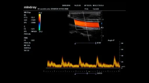 Mindray™ M6 Point of Care Ultrasound System - Mindray USA - Image 5