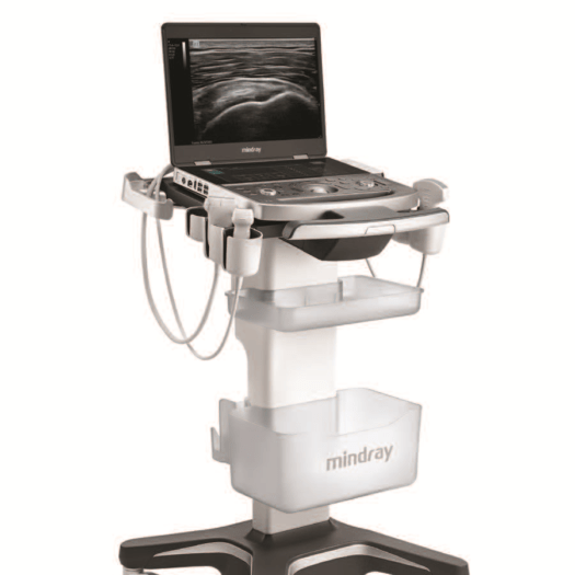 Mindray MX8 MSK Ultrasound System