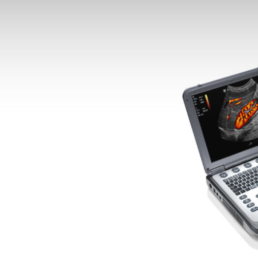 Mindray M6 Portable Ultrasound System