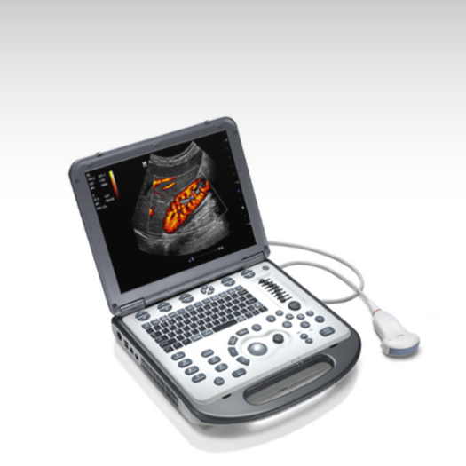 Mindray M6 Portable Ultrasound System