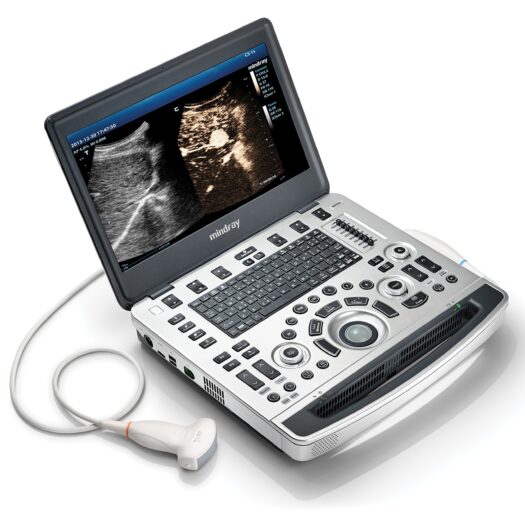 Mindray M8 Elite Portable Ultrasound System