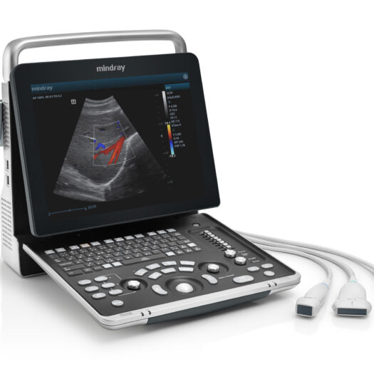 Mindray Z60 Diagnostic Ultrasound System